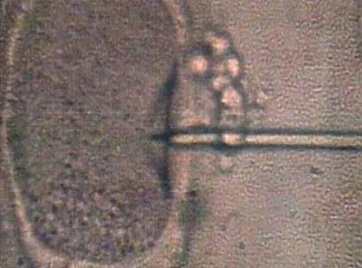 تقنية التلقيح الاصطناعي تظهر عملية دمج الحمض النووي من ثلاثة أشخاص، مما يتيح ولادة أطفال أصحاء ويعطي الأمل للعائلات.