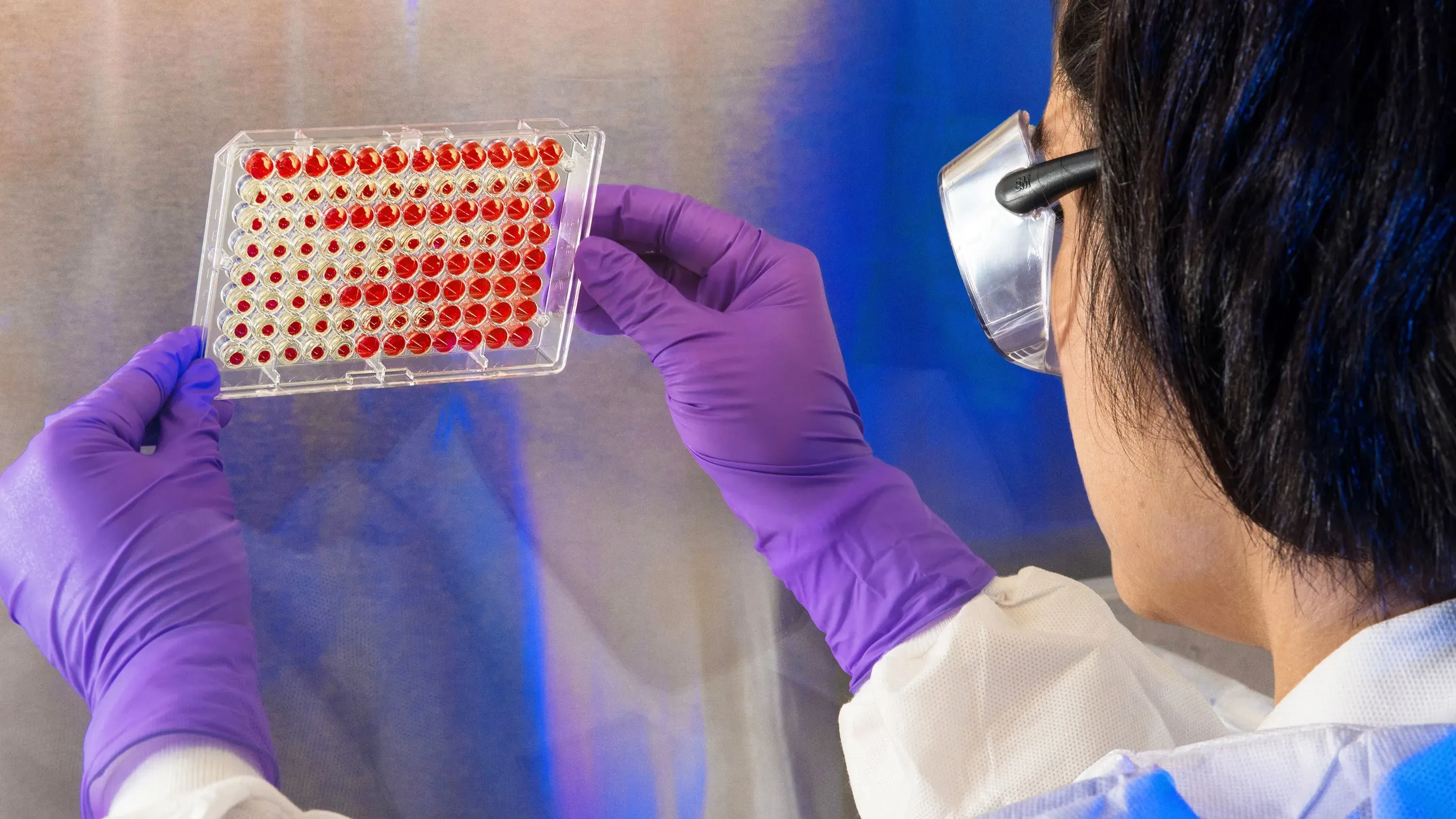 عالمة ترتدي قفازات أرجوانية ونظارات واقية، تحمل صينية تحتوي على عينات حمراء وشفافة، مما يعكس جهود البحث في مجال الصحة العامة.