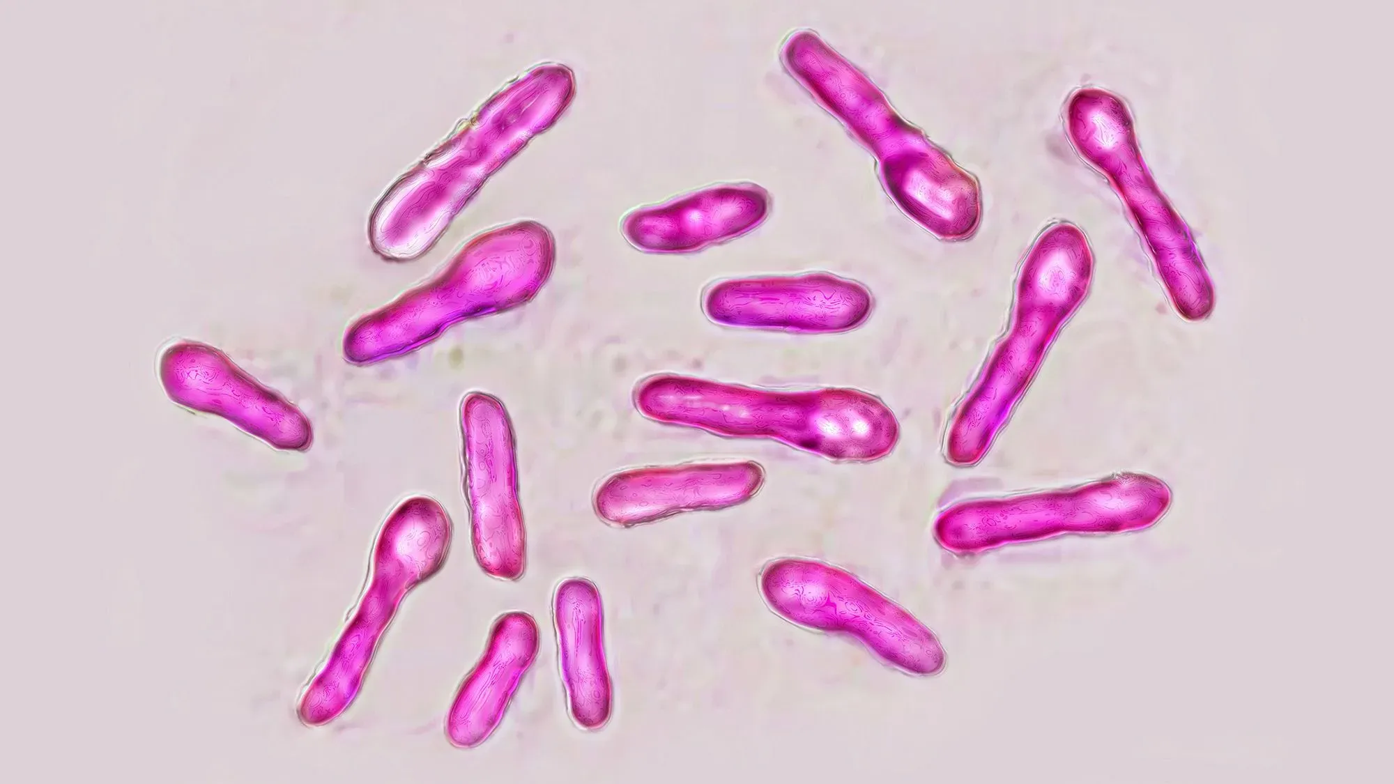 بكتيريا كلوستريديوم بوتولينوم تحت المجهر، المسؤولة عن التسمم الغذائي المرتبط بعمليات البوتوكس، تظهر بشكل خيوط وردية.