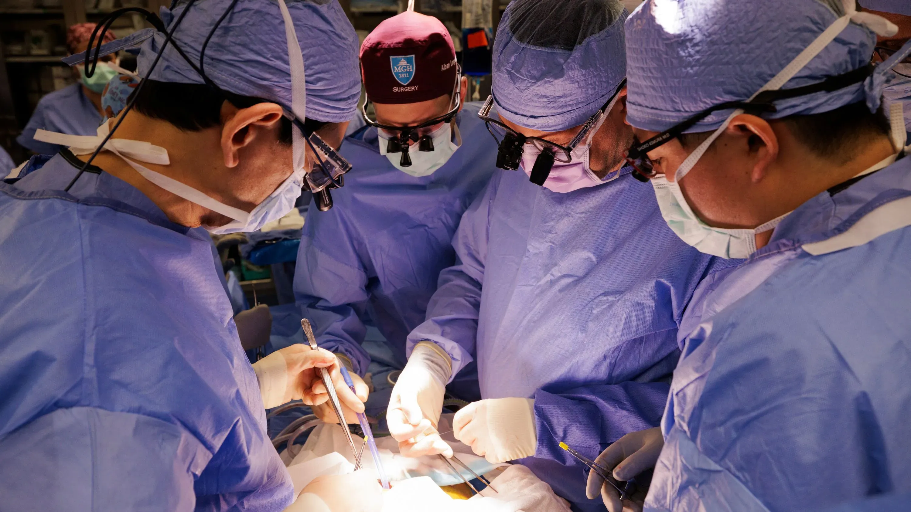 جراحون يرتدون ملابس طبية زرقاء أثناء إجراء عملية زرع كلية خنزير، مما يمثل تقدمًا في زراعة الأعضاء الحيوانية للبشر.