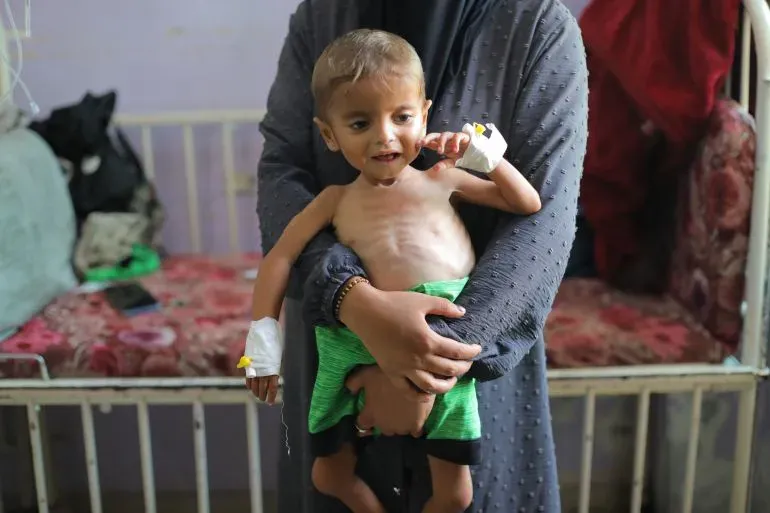 طفل نحيف يعاني من سوء التغذية، في حضن والدته، داخل مستشفى في غزة. تعكس الصورة الوضع الإنساني الكارثي في المنطقة.
