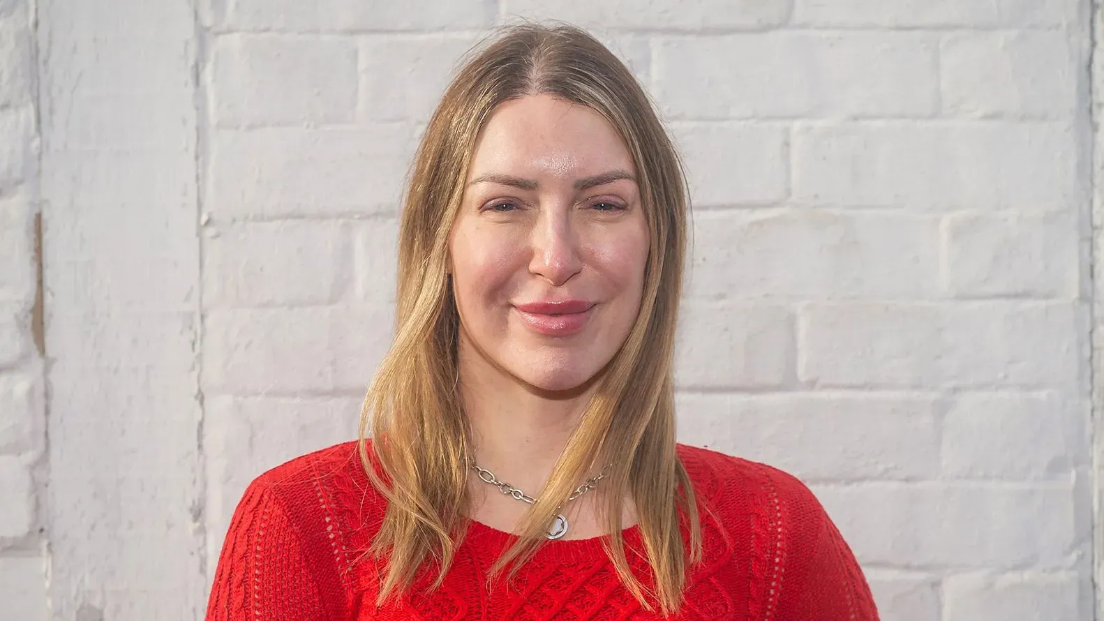 امرأة شابة ترتدي سترة حمراء، مبتسمة، وتقف أمام جدار أبيض، تعكس ثقتها بعد خضوعها لجراحة زراعة الشعر.