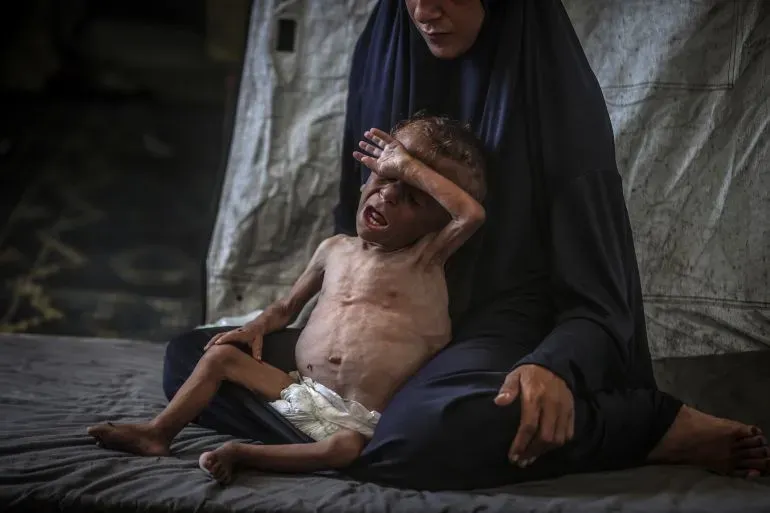 طفل نحيف يجلس بجانب والدته في خيمة، يعبر عن معاناته بسبب سوء التغذية في غزة، وسط ظروف إنسانية صعبة.
