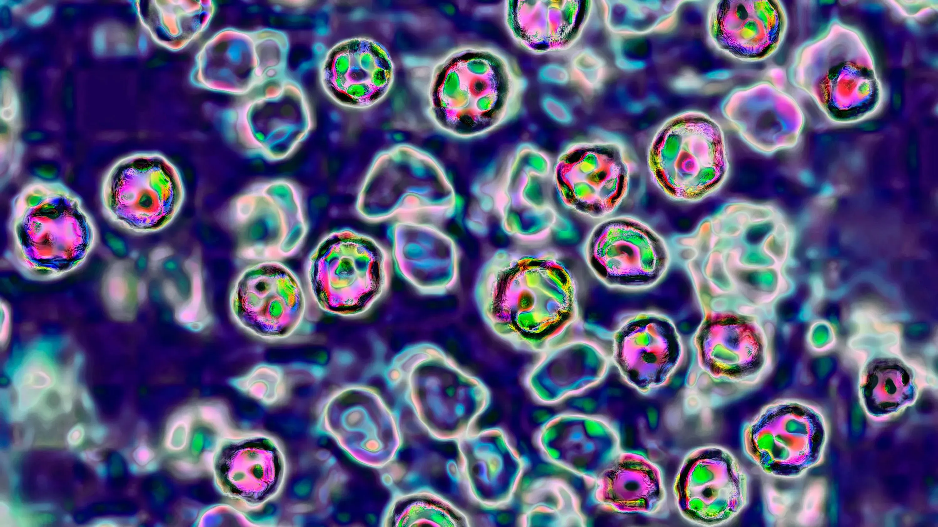 تظهر الصورة خلايا فيروس الحصبة، مما يعكس تفشي المرض في كانساس، حيث ارتفعت الحالات بين غير الملقحين.