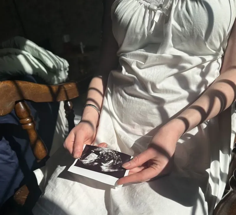 امرأة ترتدي فستانًا أبيض وتحمل صورة أشعة فوق صوتية لطفلها، بينما تسقط ظلال على ذراعيها، تعكس مشاعر القلق حول مستقبل طفلهما في ظل التوترات السياسية.