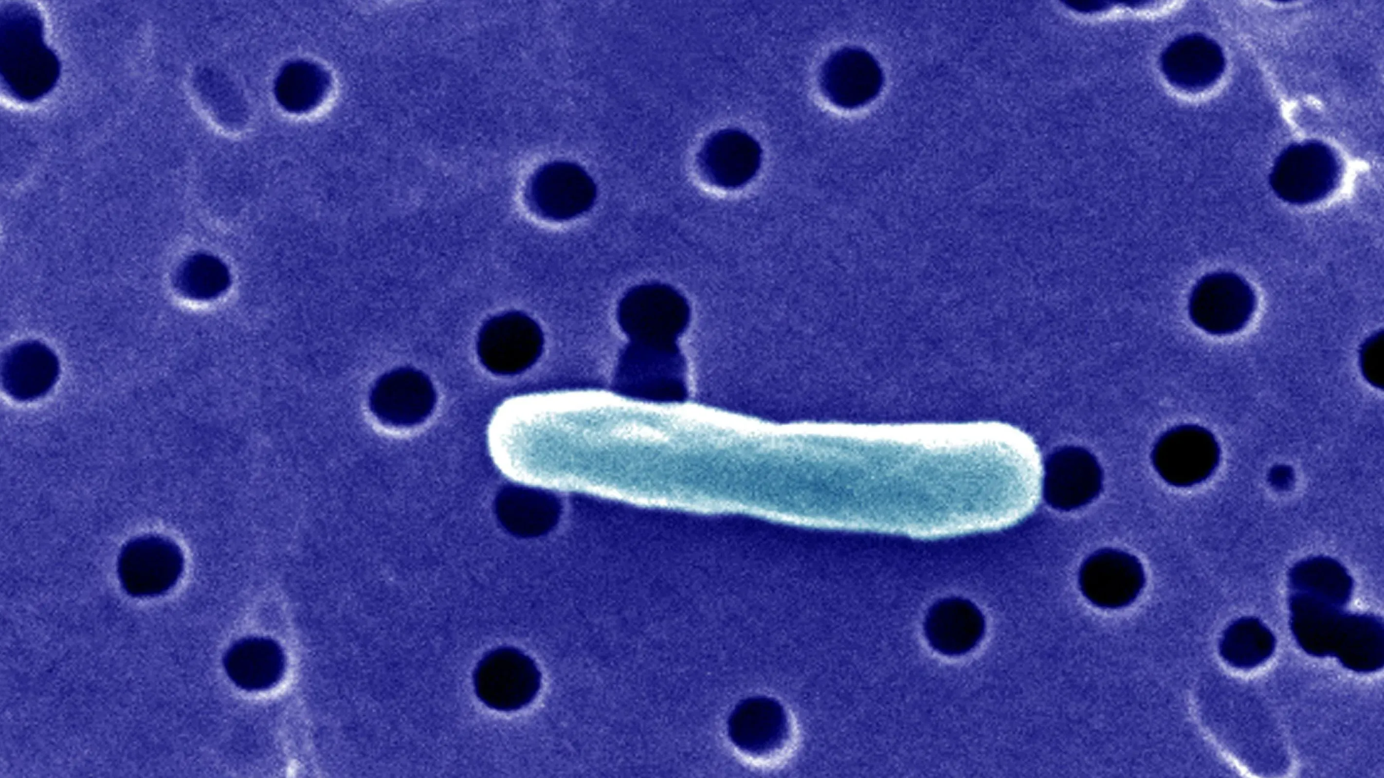 صورة مكبرة لبكتيريا الكامبيلوباكتر، المسببة للتسمم الغذائي، والتي ارتبطت بتفشي حالات التسمم في فلوريدا بسبب الحليب الخام.