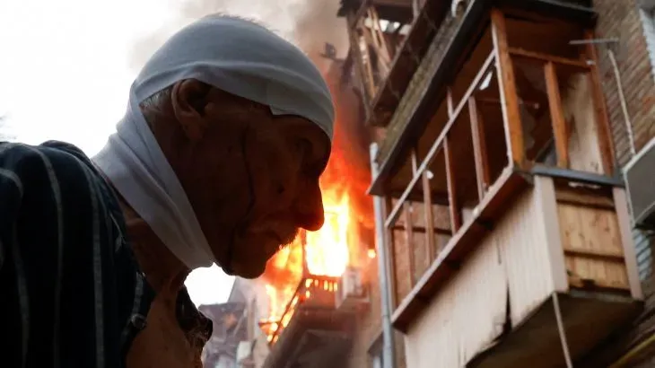 رجل مسن مصاب بجروح، يقف أمام مبنى محترق في كييف، مشهد يعكس آثار القصف الروسي على المدينة وتأثيره على المدنيين.