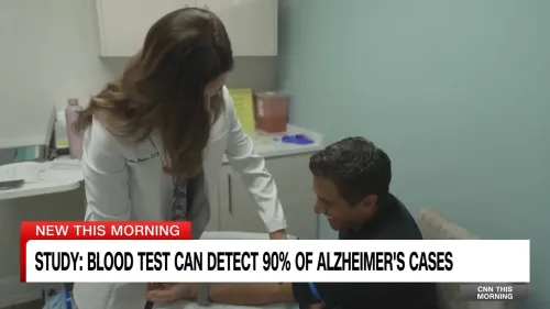 دراسة تشير إلى أن اختبار دم يمكنه اكتشاف 90% من حالات الزهايمر، مع طبيب يقوم بأخذ عينة دم من مريض.