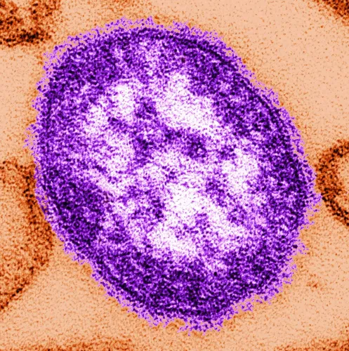 فيروس الحصبة يظهر تحت المجهر الإلكتروني، مع تفاصيل دقيقة توضح تركيبه، مما يعكس تفشي المرض في الولايات المتحدة.
