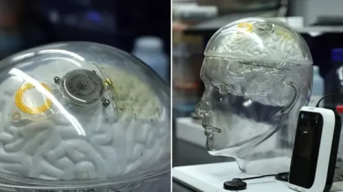 نموذج لواجهة حاسوبية لاسلكية للدماغ، يظهر شريحة بيناو-1 داخل رأس شفاف، يمثل تقدم التكنولوجيا في علاج مرضى التصلب الجانبي الضموري.