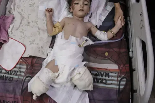 طفل مصاب بجروح خطيرة في مستشفى بغزة، حيث تظهر الضمادات على جسده، مما يعكس تأثير الحرب على الأطفال.