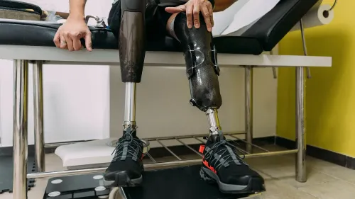 رجل يجلس على أريكة، يظهر ساقاه الاصطناعيان، أحدهما مصنوع من الكربون والآخر معدني، يرتدي حذاء رياضي.