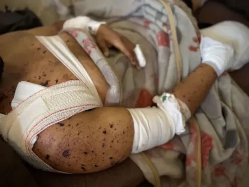 جسد مصاب ملطخ بالدماء ومربوط بضمادات، يظهر آثار جروح متعددة، يعكس معاناة الضحايا في غزة خلال النزاع المستمر.