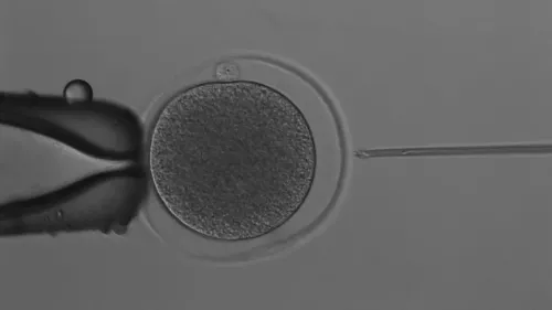 نجح العلماء في أستراليا في إنتاج جنين كنغر عبر التلقيح الاصطناعي، مما يعزز جهود الحفاظ على الأنواع المهددة بالانقراض.