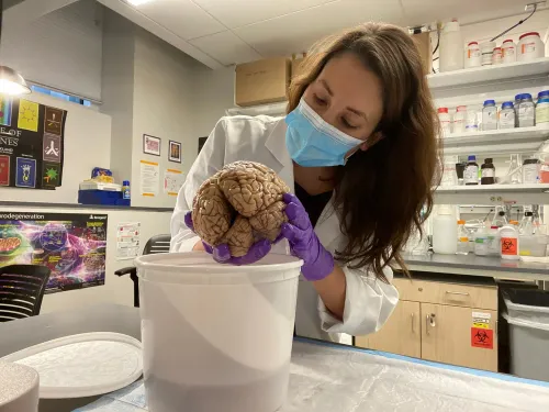 باحثة ترتدي قناعًا وقبعة مختبر، تحمل دماغًا بشريًا في مختبر، مما يبرز أهمية دراسة أنسجة الدماغ لفهم الشيخوخة والذاكرة.