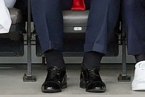 صورة تظهر قدمي الرئيس ترامب مرتديًا حذاءً أسود، مع انتفاخ طفيف في الساقين، مما يعكس حالته الصحية المتعلقة بالقصور الوريدي المزمن.