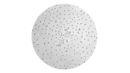 صورة توضح بكتيريا السعال الديكي تحت المجهر، مما يعكس زيادة حالات الإصابة بالمرض وتأثيره على الأطفال.