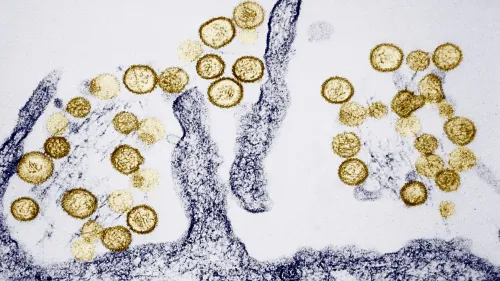 صورة توضح فيروس هانتا تحت المجهر، حيث تظهر جزيئات الفيروس بشكل دائري وموزعة على خلفية رئوية، مما يعكس تأثيره على الجهاز التنفسي.