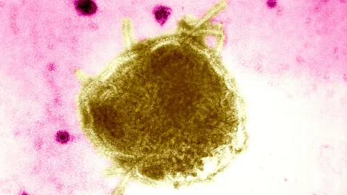 فيروس الحصبة تحت المجهر، يظهر بلون بني على خلفية وردية، مما يبرز خطورته وانتشاره في تفشي المرض.