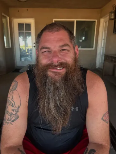 ابتسامة رجل ذو لحية كثيفة، يجلس في مكان داخلي، مع خلفية تحتوي على نوافذ وأبواب زجاجية، بعد تعرضه لإصابات في حادث مصارعة.