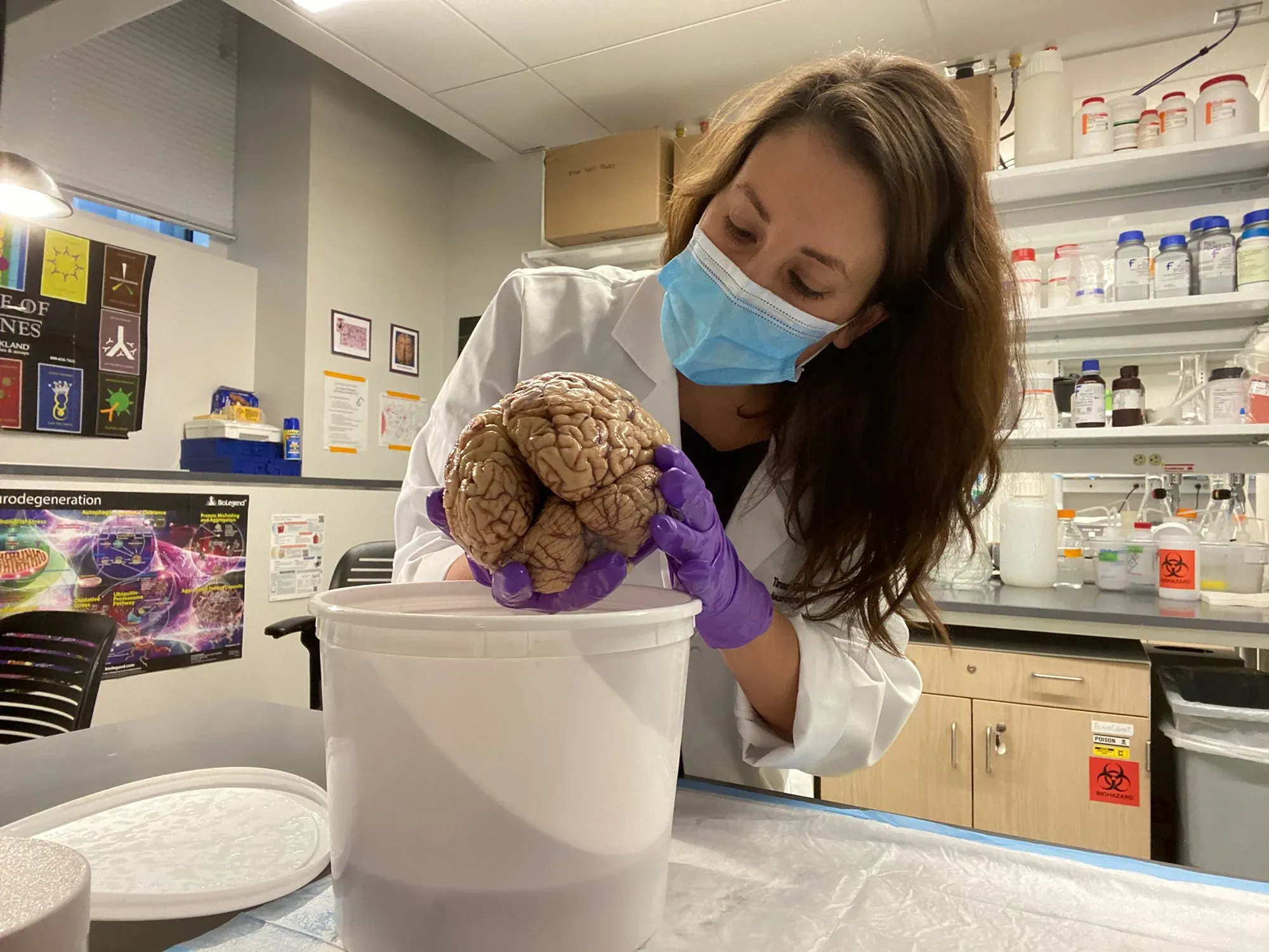 باحثة ترتدي قناعًا وقبعة مختبر، تحمل دماغًا بشريًا في مختبر، مما يبرز أهمية دراسة أنسجة الدماغ لفهم الشيخوخة والذاكرة.