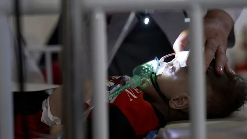 طفل يعاني من سوء التغذية في مستشفى بأفغانستان، يتلقى الرعاية الطبية بينما يمسك به أحد الأطباء، مما يعكس أزمة صحية متفاقمة.