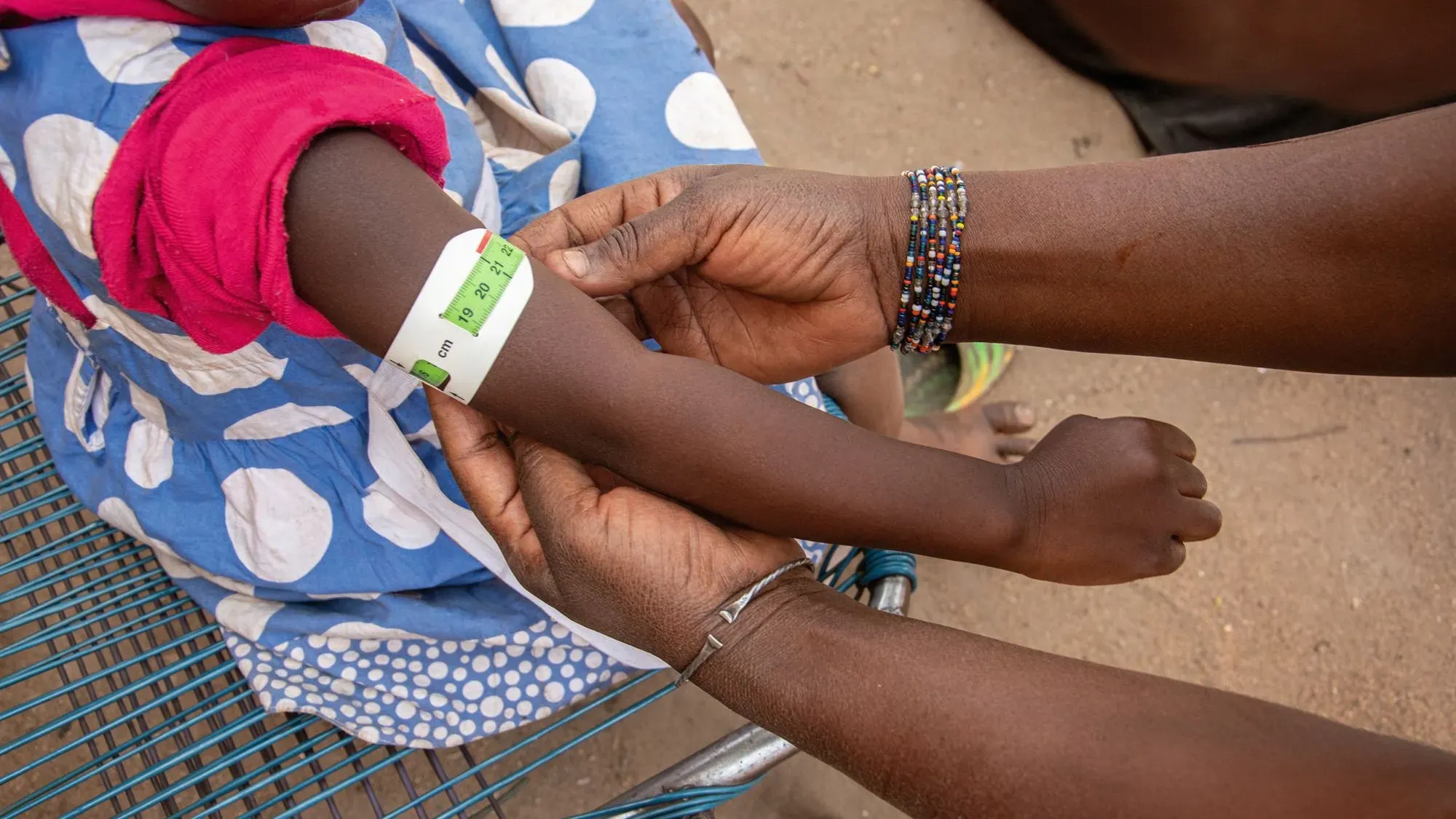 طفل يعاني من سوء التغذية يتم قياس محيط ذراعه باستخدام شريط قياس، في سياق جهود منظمة العمل ضد الجوع في نيجيريا.