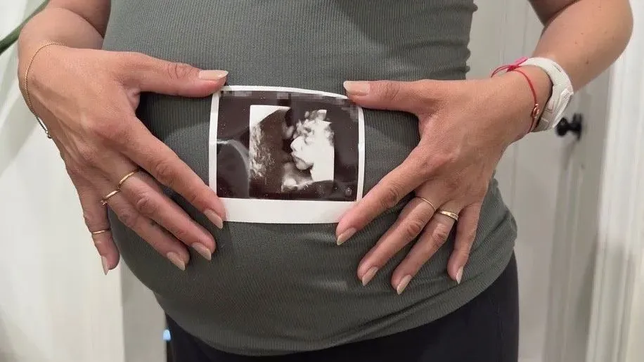 امرأة حامل ترتدي قميصًا رماديًا، تمسك بصورة بالأشعة فوق الصوتية لطفلها، تعبر عن القلق بشأن الجنسية في ظل التغييرات القانونية.