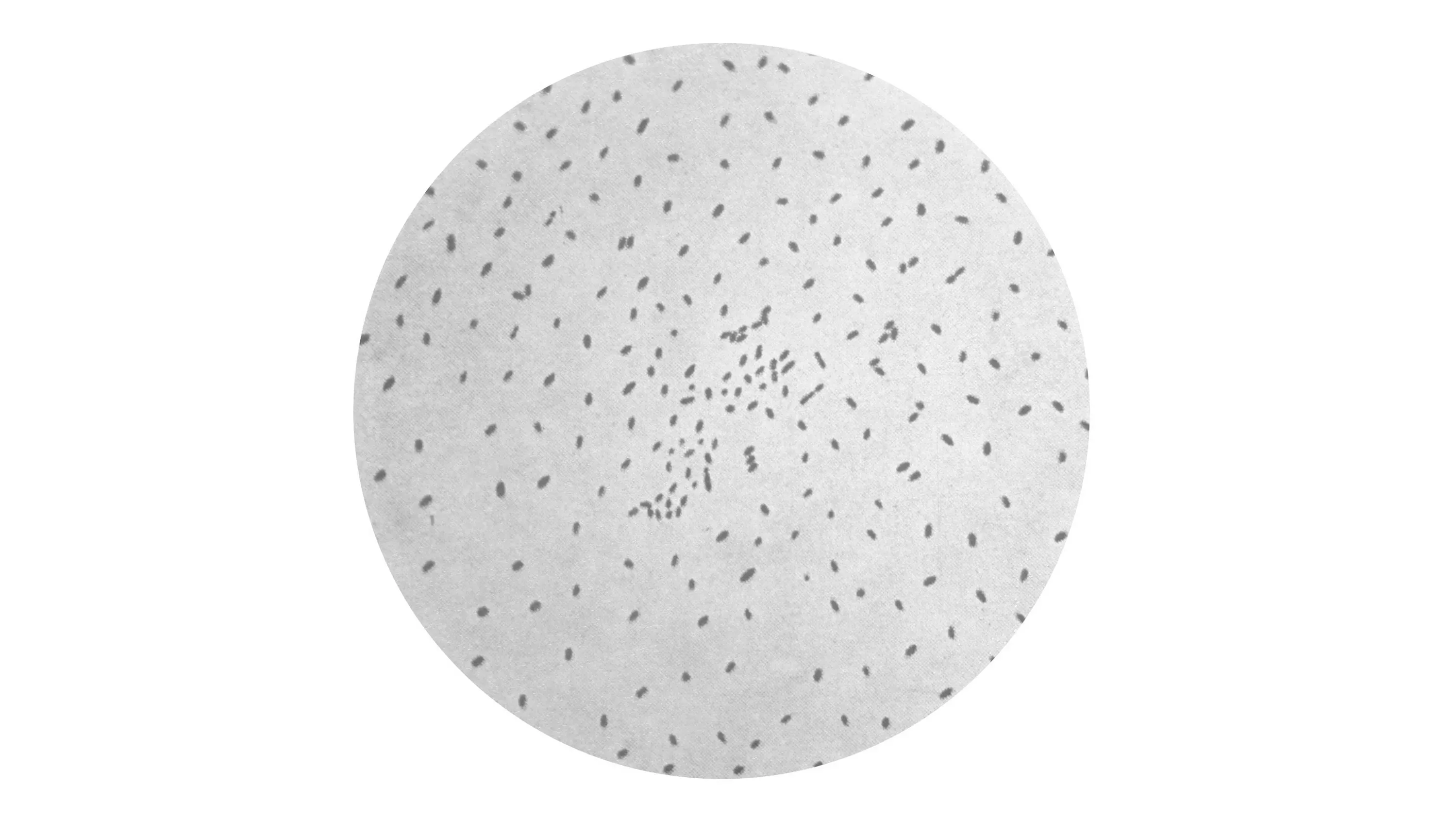 صورة توضح بكتيريا السعال الديكي تحت المجهر، مما يعكس زيادة حالات الإصابة بالمرض وتأثيره على الأطفال.