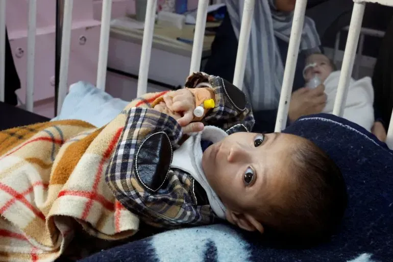 طفل مريض يعاني من سوء التغذية في مستشفى بغزة، يظهر عليه علامات التعب والضعف، بينما تُظهر الخلفية مريضًا آخر.