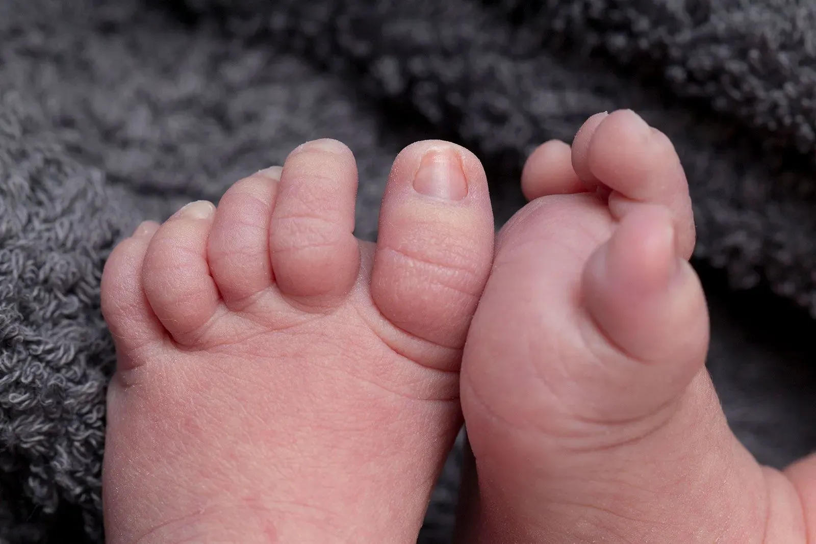 أقدام طفلين حديثي الولادة، تظهر تفاصيل الأصابع والجلد، تعكس موضوع وفيات الأجنة وتحسينات الرعاية الصحية.