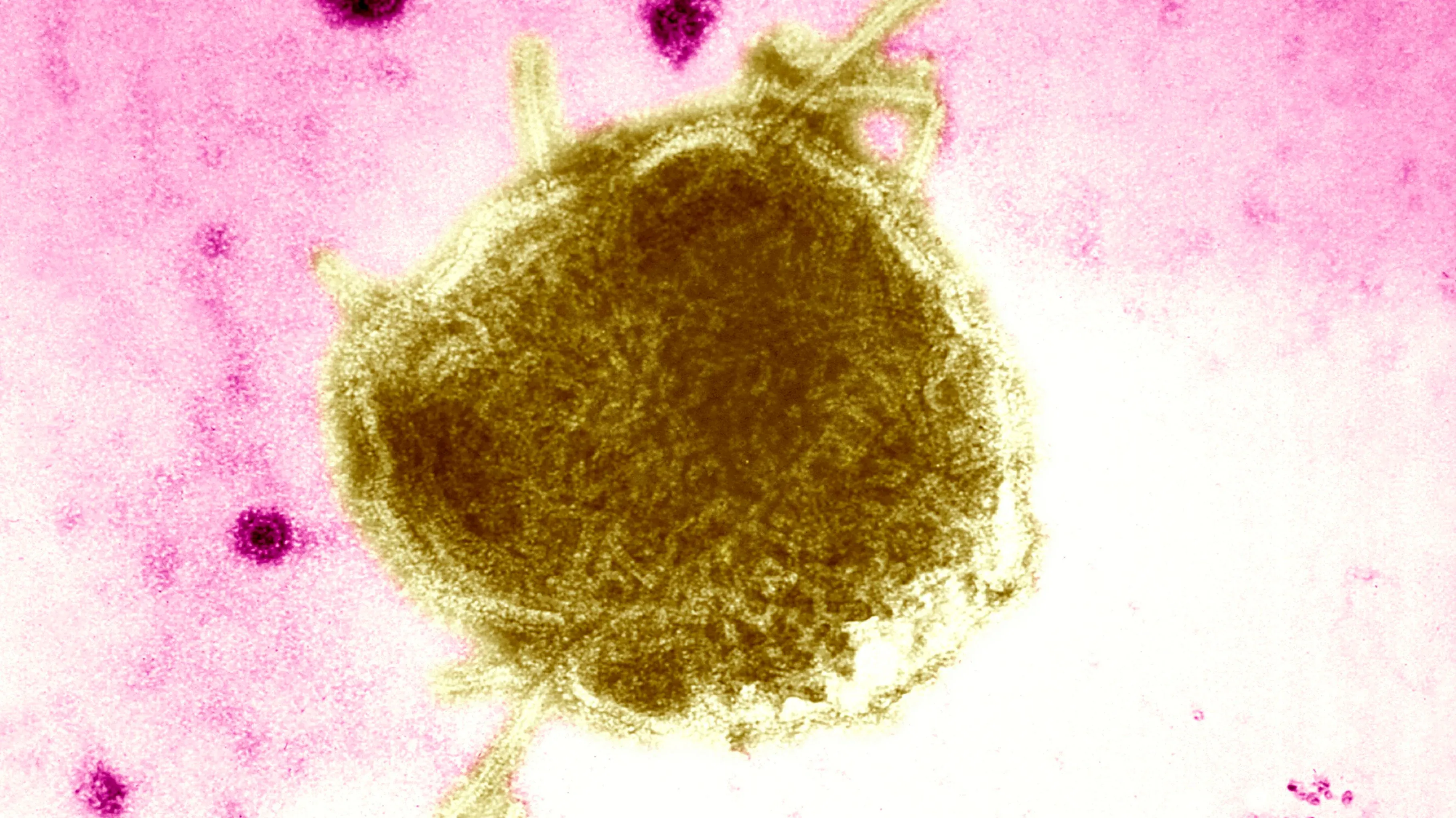 فيروس الحصبة يظهر تحت المجهر، محاطًا بخلفية وردية. يسلط الضوء على أهمية التطعيم لمواجهة تفشي المرض.