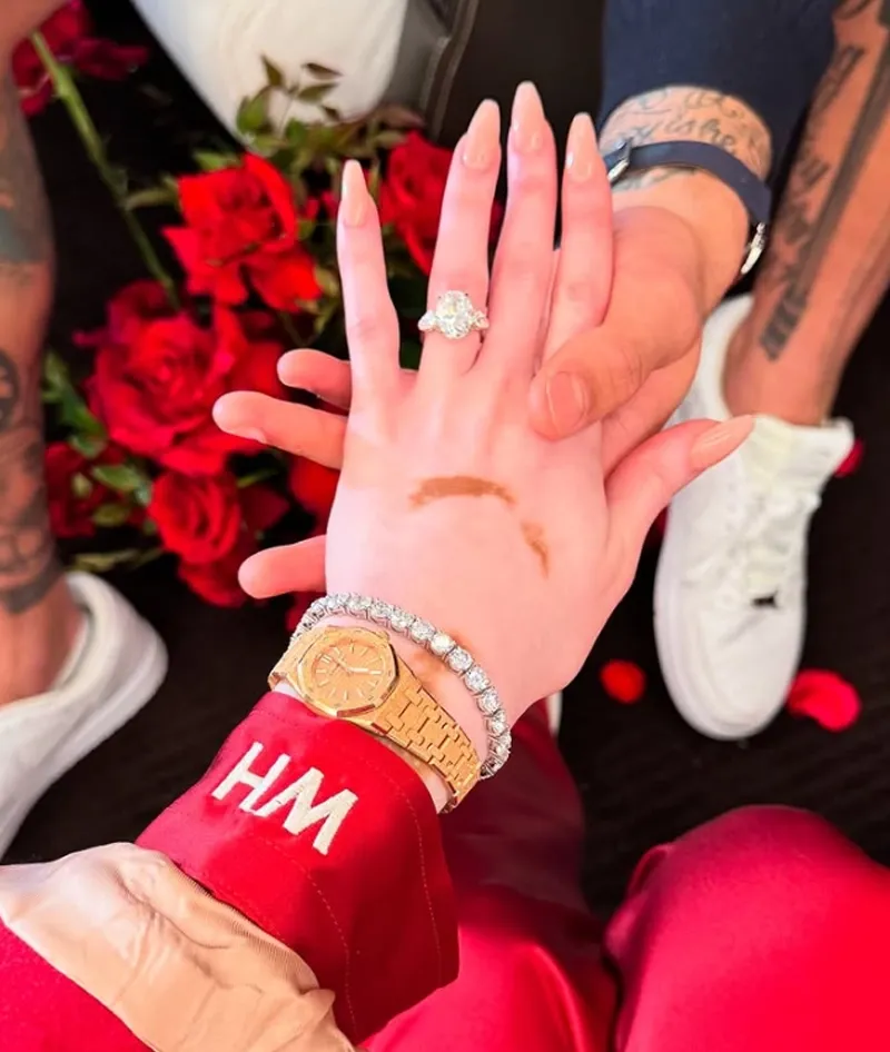 ويني هارلو وكايل كوزما يتبادلان القبل أثناء احتفالهما بخطوبتهما، حيث يظهر خاتم الخطوبة المميز في الصورة.